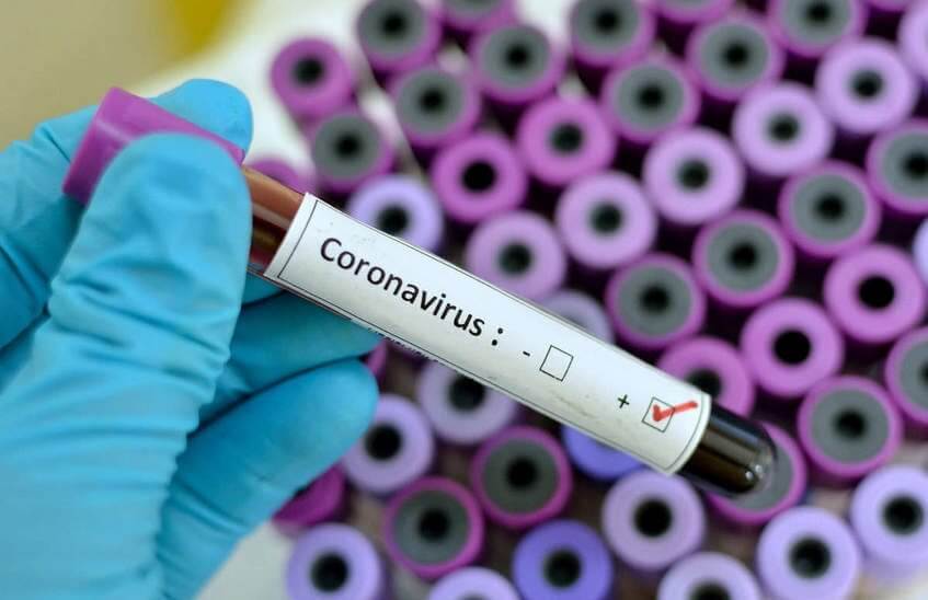9 саровчан лечатся от коронавируса в больнице