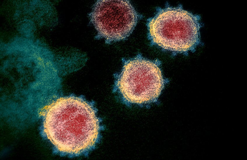 Ученые установили температуру и время гибели коронавируса