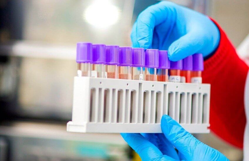 45 новых случаев коронавируса выявлено за выходные в Сарове