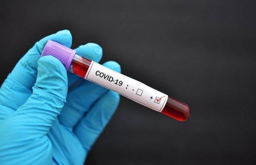 56 саровчан остаются в больнице с коронавирусом