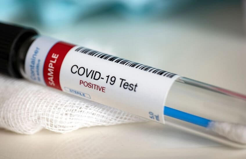 99 случаев коронавируса зарегистрировано в Сарове за сутки