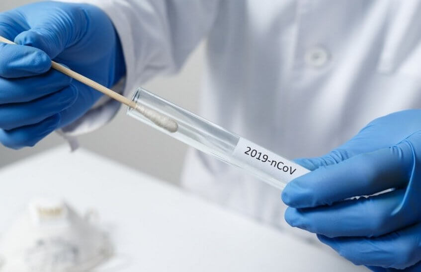 450 анализов на коронавирус проведено в Сарове за сутки
